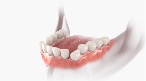 Orthodontics Treatments