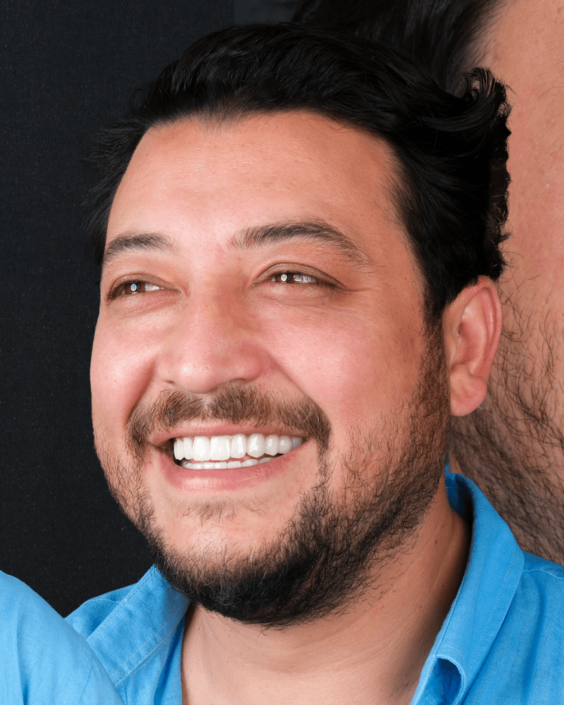 17-Mayis-BA-2 - Dr Smile Antalya