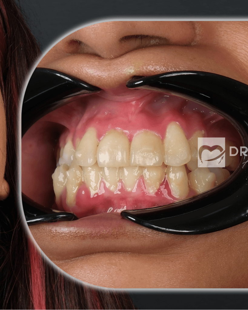 27-Mayis-BA-1_0001_Katman-4 - Dr Smile Antalya