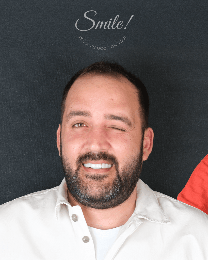 30-Nisan-Before-AfterCalisma-yuzeyi-1 (1) - Dr Smile Antalya