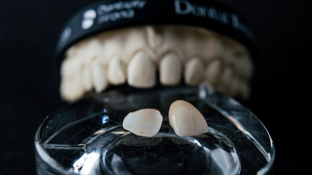 7 - Dr Smile Antalya