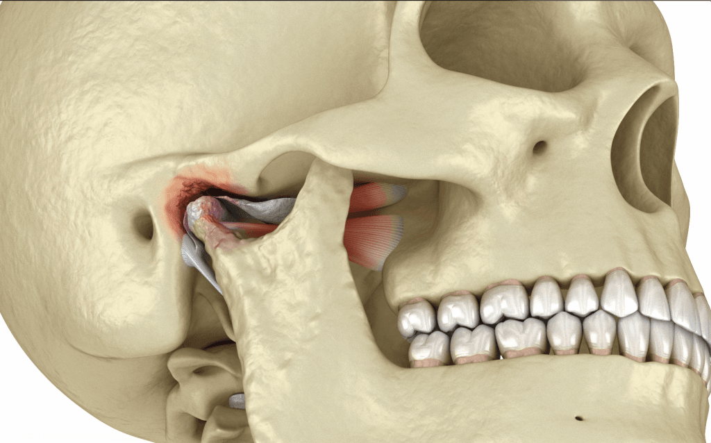 Ekran-Resmi-2025-06-02-15.25.14 - Dr Smile Antalya