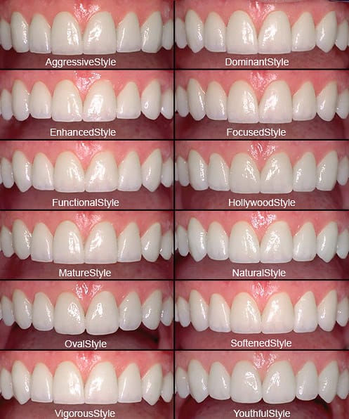 smile-design - Dr Smile Antalya
